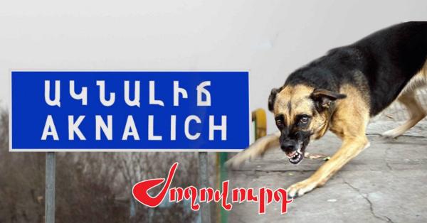 ՏԵՍԱՆՅՈՒԹ․ 3 տարեկան երեխան մահшցել է կատաղած շան կծելուց. մանրամասներ