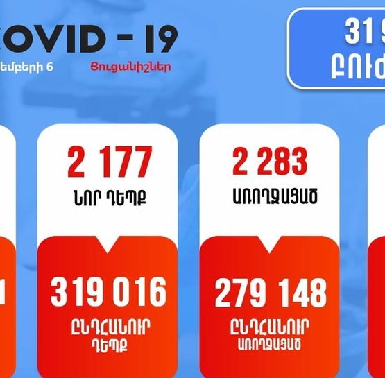 Ունենք կորոնավիրուսի 2177 նոր դեպք, 46 մահ