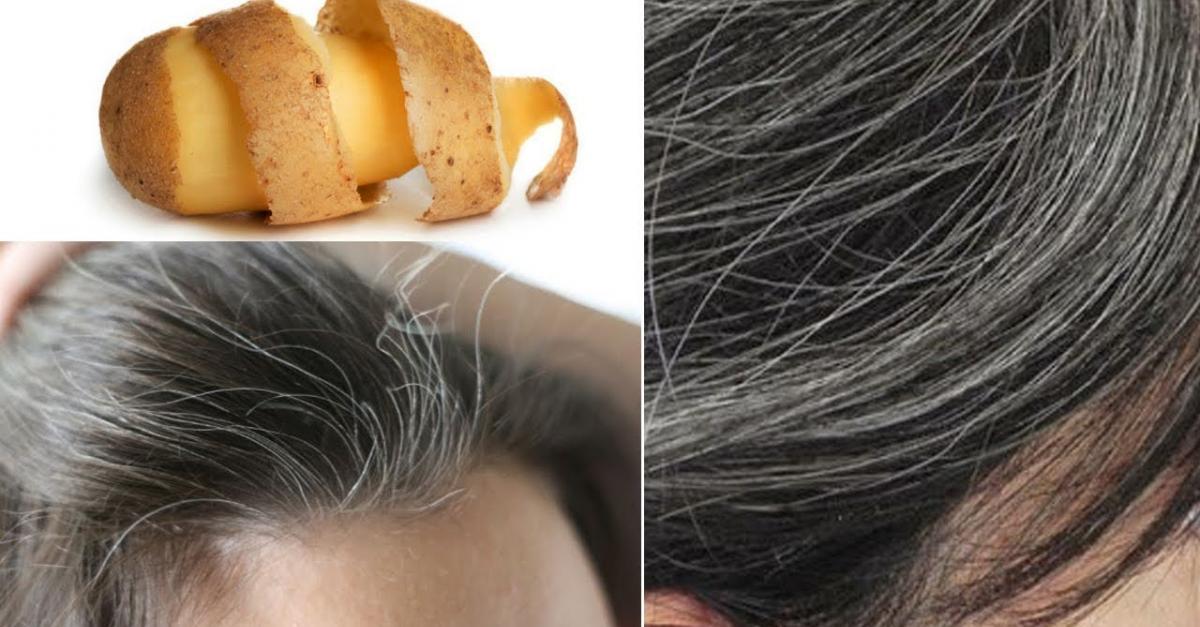Ինչպե՞ս կարտոֆիլի օգնությամբ վերացնել մազաթափությունը և ստիպել մազերին աճել․ Փորձված միջոց