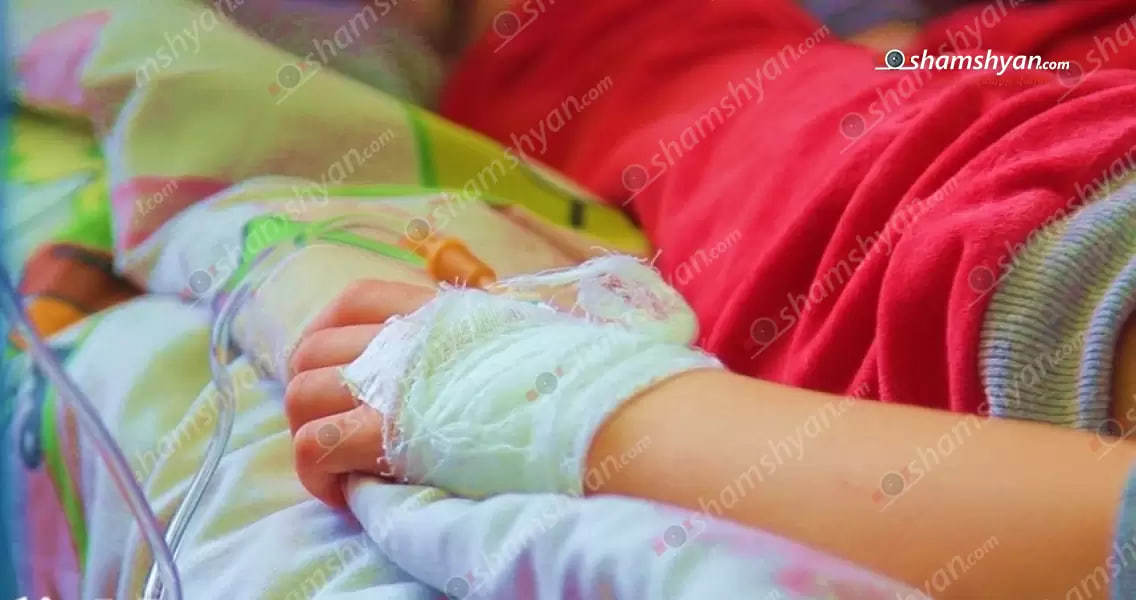 1,5 տարեկան երեխան ջերմային այրվшծքներով տեղափոխվել է «Այրվածքաբшնական ազգային կենտրոն»