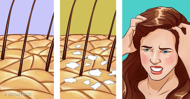 If You’re Tired of Having an Itchy Scalp, Here’s What You Need to Know