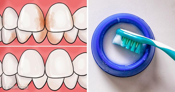 10 Ways to Remove Tartar Stains From Your Teeth