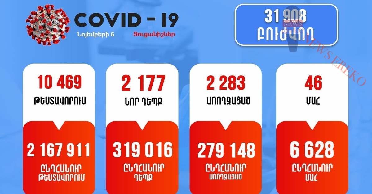 Ունենք կորոնավիրուսի 2177 նոր դեպք, 46 մահ