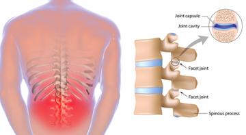 5 растяжек, которые могут помочь предотвратить и облегчить боль в нижней части спины