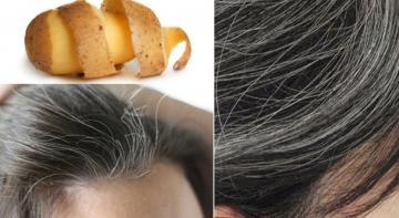 Ինչպե՞ս կարտոֆիլի օգնությամբ վերացնել մազաթափությունը և ստիպել մազերին աճել․ Փորձված միջոց
